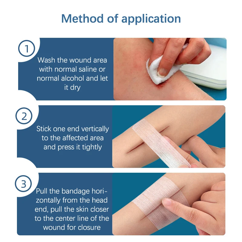 2/3/5 Strips 10cm Adhesive Sterile Medical Bandage Strips Wound Closure Tapes Skin Repair First Aid Surgical Breathable Tape - الصورة 5